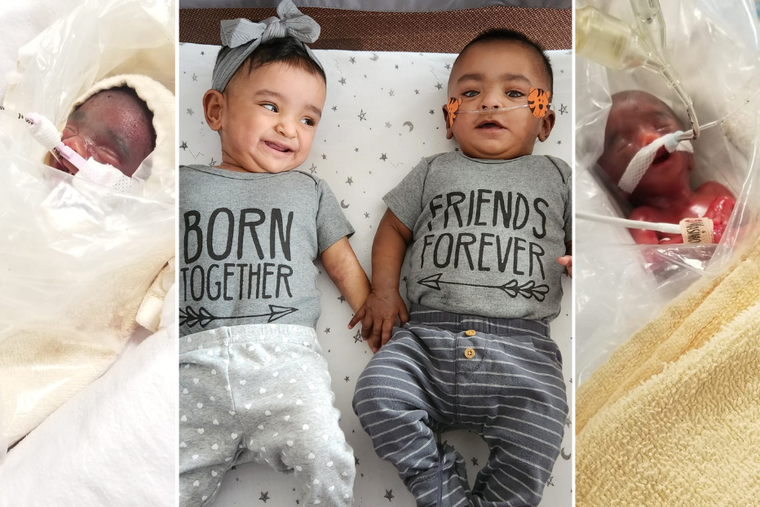 Just one hour after midnight on March 4, 2022, putting the babies at 22-weeks gestation, Adiah Laelynn Nadarajah came into this world, weighing just under 12 ounces. Brother Adrial Luka Nadarajah followed her 23 minutes later, weighing just under 15 ounces.